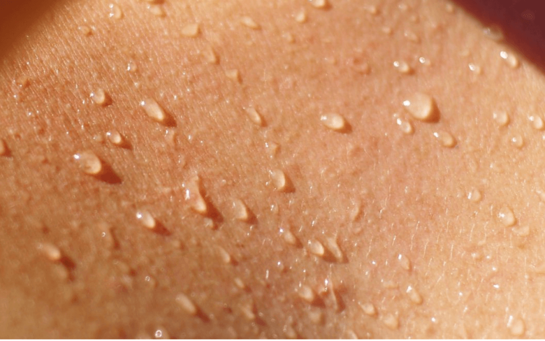 Sweat on Skin Mirial Clinical