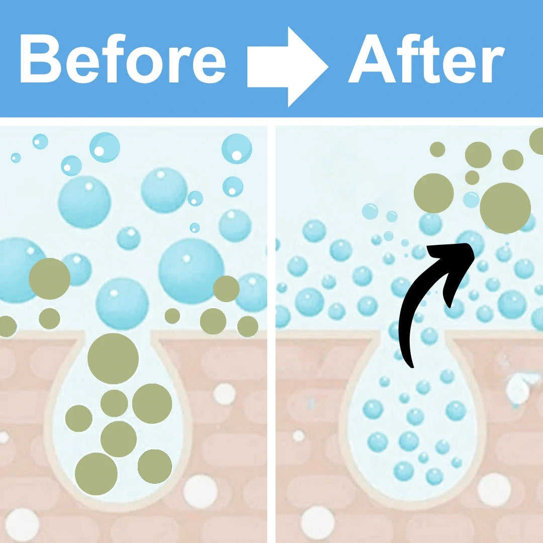 Before and after using Mirai Clinical's nylon soap saver scrub bag, showing enhanced rich bubbles and lathering effect from the soap saver bag and travel sponge.