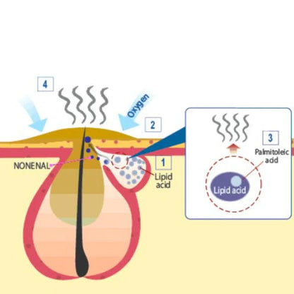 The diagram explains the production of Nonenal, a body odor caused by lipid oxidation and palmitoleic acid, which increases with aging and hormonal changes.
